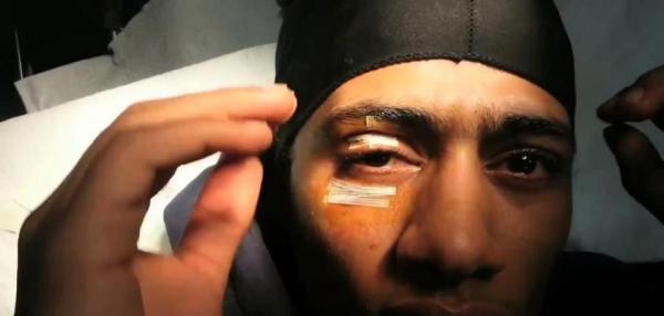 بالصور أسد يصيب محمد رمضان بجرح فوق عينه