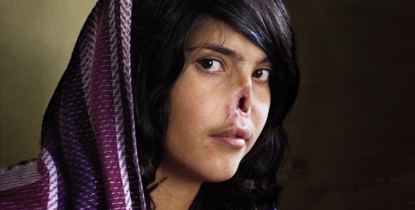 بالصور والفيديو رجل افغانستاني يقطع أنف وشفتي زوجته  تعرف على السبب