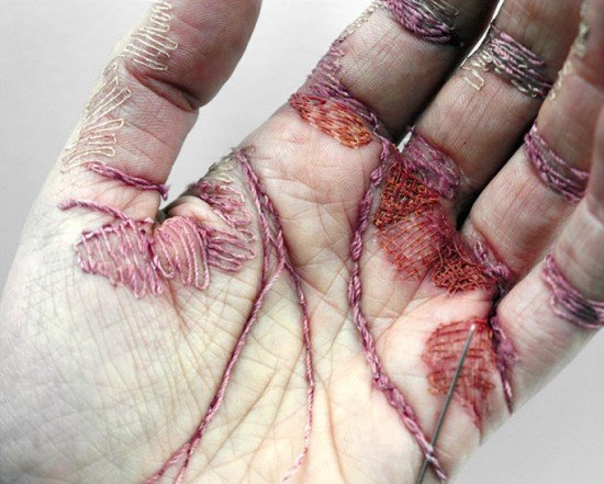 بالصور فتاة بريطانيا تخيط كف يدها بخيوط ملونة