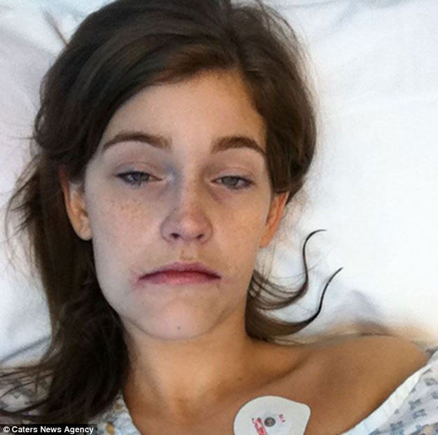 امرأة بريطانية تجرى عملية جراحية لتبتسم لأول مرة فى حياتها - صور