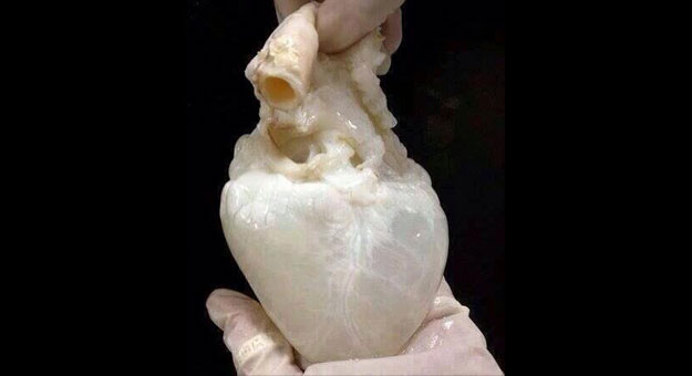 شاهد صور قلب الإنسان بدون دم