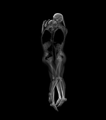 صور أجسام الأشخاص بالأشعة المقطعية والسينية