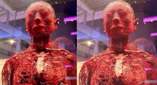 بالصور شاهد تقسيم شرايين جسم الإنسان