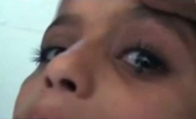بالفيديو طفلة صغيرة تبكى حصى بدلا من الدموع في اليمن
