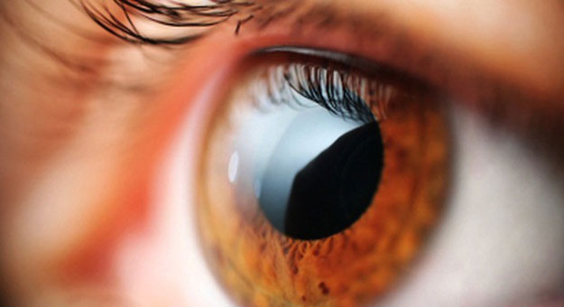 وصفة سهلة وطبيعية للتخلص من احمرار العين