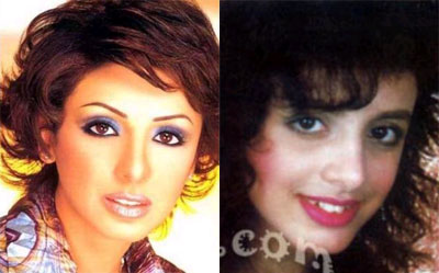 صور نجمات الغناء العربي قبل وبعد عمليات التجميل 2014