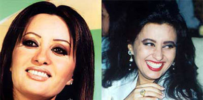 صور نجمات الغناء العربي قبل وبعد عمليات التجميل 2014