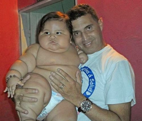 صور اضخم طفل رضيع في العالم بكولومبيا وزنه 20 كيلوجراماً
