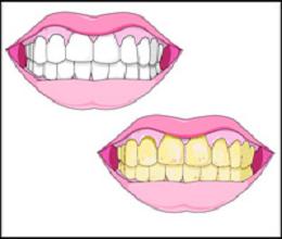 نصائح للتخلص من مشكلة اصفرار الاسنان 2014