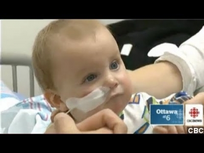 بالفيديو طفل صغير لا يقدر على فتح فمه ويتغذى باستخدام أنفه