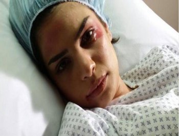 صورة ريتا حايك على سرير بالمستشفى والكدمات تغطي وجهها