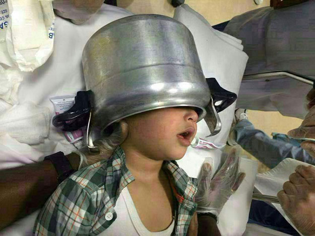 بالصور انقاذ طفل سعودي من طنجره علقت في رأسه