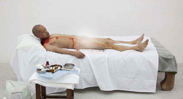 بالصور صيني ينتزع ضلع من جسده بدون تدخل طبي