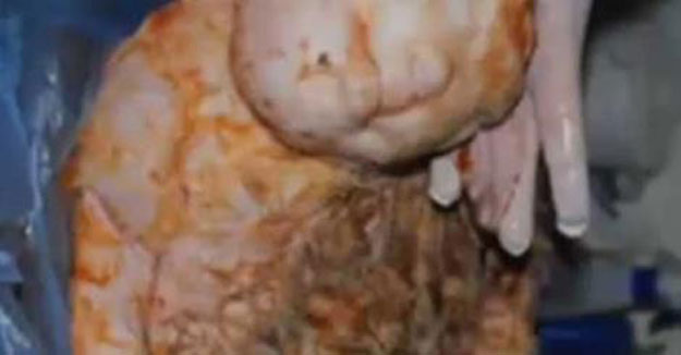 بالفيديو والصور ولادة خروف بوجه إنسان في تركيا 2014