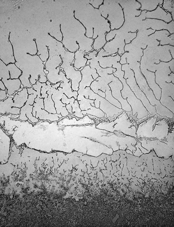 بالصور دموع الانسان تحت المجهر من تصوير الفنان كاراغر كرول