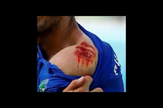 صور مضحكة على عضة سواريز لمدافع إيطاليا في كأس العالم 2014