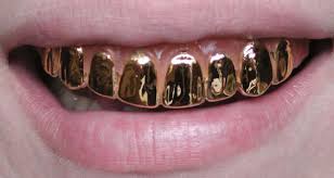 صور أغلى طقم أسنان في العالم من الذهب قيمته 153 ألف دولار
