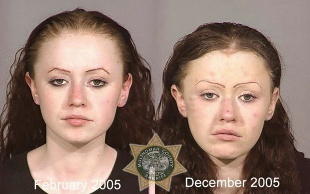 بالصور تأثير المخدرات على ملامح الوجه