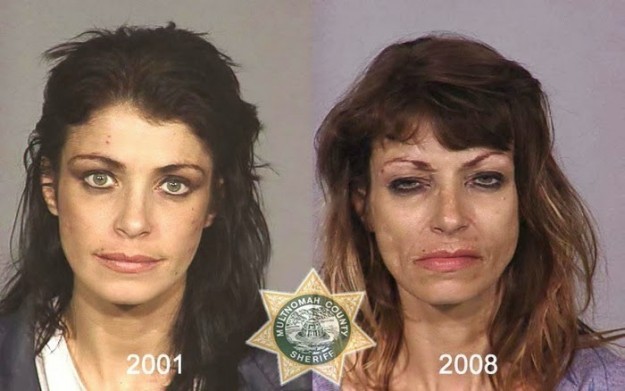 بالصور تأثير المخدرات على ملامح الوجه