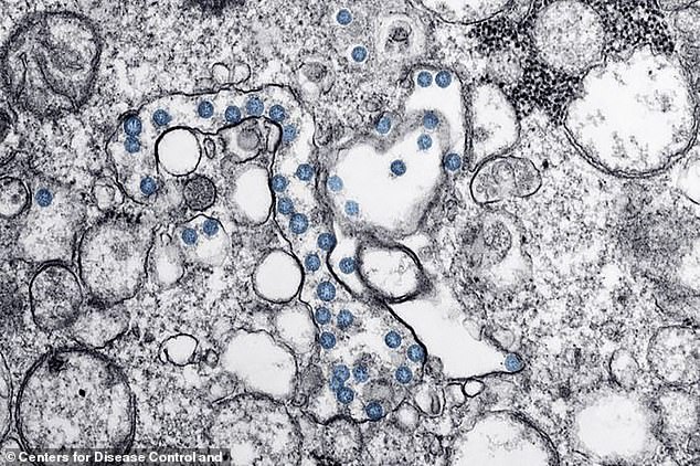 بالصور كيف يغزو فايروس كورونا خلايا الجسم 2020
