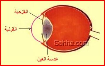 قرحة القرنية Corneal Ulcer